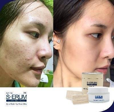 รีวิวจากผู้ใช้ S-ERUM ทั่วประเทศ 10.jpg