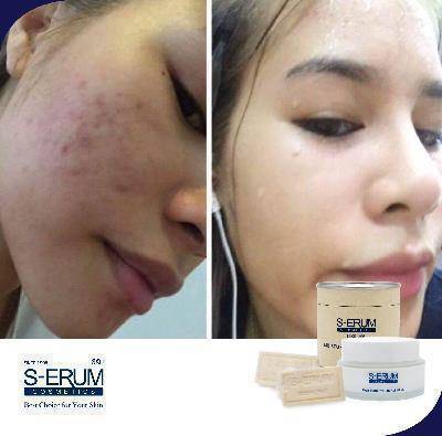 รีวิวจากผู้ใช้ S-ERUM ทั่วประเทศ 20.jpg