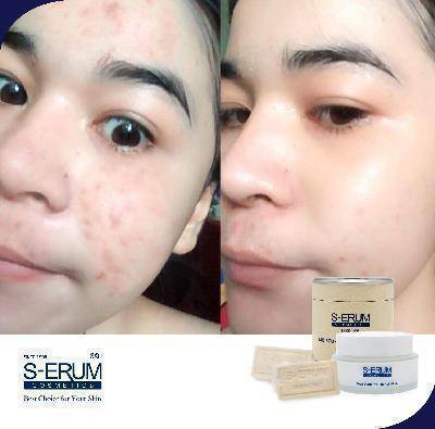 รีวิวจากผู้ใช้ S-ERUM ทั่วประเทศ 21.jpg