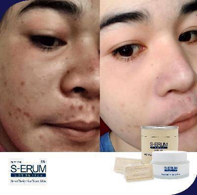 รีวิวจากผู้ใช้ S-ERUM ทั่วประเทศ 22.jpg