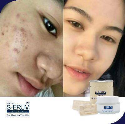 รีวิวจากผู้ใช้ S-ERUM ทั่วประเทศ 23.jpg
