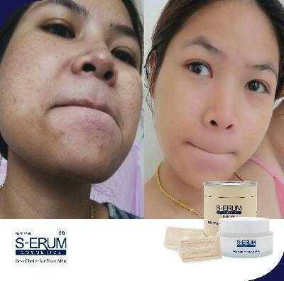 รีวิวจากผู้ใช้ S-ERUM ทั่วประเทศ 24.jpg