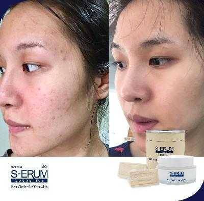 รีวิวจากผู้ใช้ S-ERUM ทั่วประเทศ 25.jpg