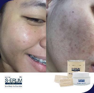 รีวิวจากผู้ใช้ S-ERUM ทั่วประเทศ 30.jpg