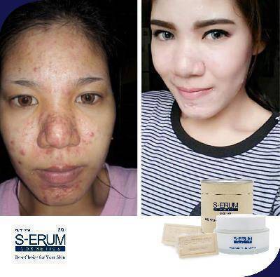 รีวิวจากผู้ใช้ S-ERUM ทั่วประเทศ 31.jpg