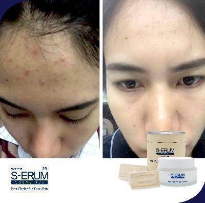 รีวิวจากผู้ใช้ S-ERUM ทั่วประเทศ 32.jpg