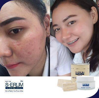 รีวิวจากผู้ใช้ S-ERUM ทั่วประเทศ 33.jpg