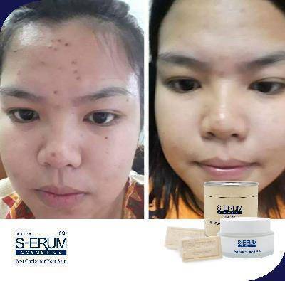 รีวิวจากผู้ใช้ S-ERUM ทั่วประเทศ 34.jpg