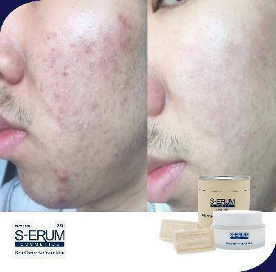 รีวิวจากผู้ใช้ S-ERUM ทั่วประเทศ 35.jpg