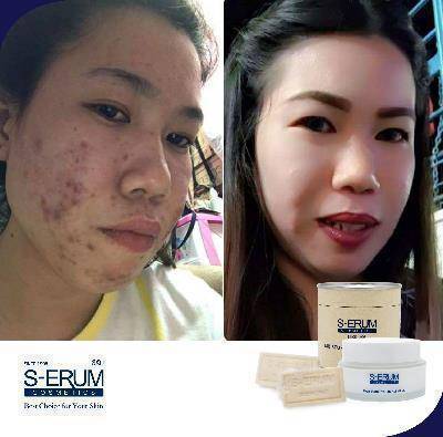 รีวิวจากผู้ใช้ S-ERUM ทั่วประเทศ 40.jpg