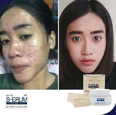 รีวิวจากผู้ใช้ S-ERUM ทั่วประเทศ 41.jpg