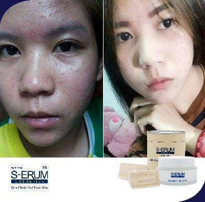 รีวิวจากผู้ใช้ S-ERUM ทั่วประเทศ 42.jpg