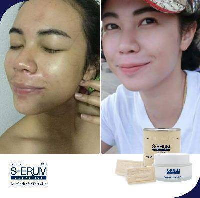 รีวิวจากผู้ใช้ S-ERUM ทั่วประเทศ 43.jpg