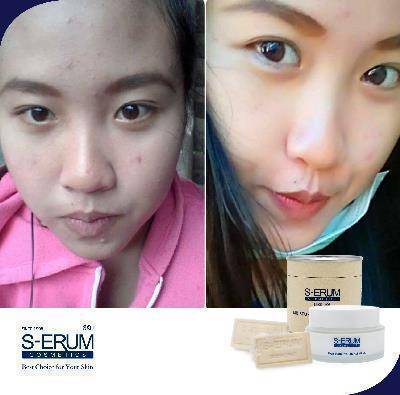 รีวิวจากผู้ใช้ S-ERUM ทั่วประเทศ 44.jpg