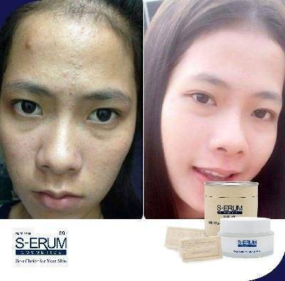 รีวิวจากผู้ใช้ S-ERUM ทั่วประเทศ 45.jpg