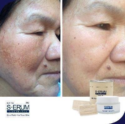 รีวิวจากผู้ใช้ S-ERUM ทั่วประเทศ 50.jpg