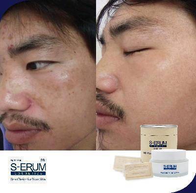 รีวิวจากผู้ใช้ S-ERUM ทั่วประเทศ 52.jpg
