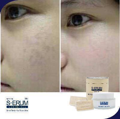 รีวิวจากผู้ใช้ S-ERUM ทั่วประเทศ 53.jpg