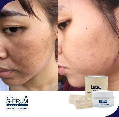 รีวิวจากผู้ใช้ S-ERUM ทั่วประเทศ 55.jpg