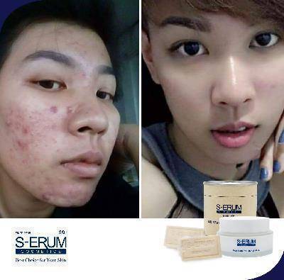รีวิวจากผู้ใช้ S-ERUM ทั่วประเทศ 56.jpg