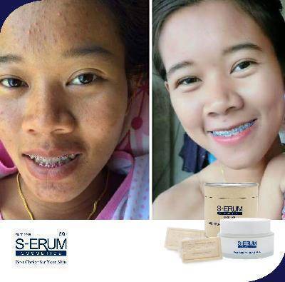 รีวิวจากผู้ใช้ S-ERUM ทั่วประเทศ 57.jpg