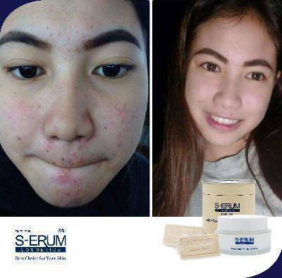 รีวิวจากผู้ใช้ S-ERUM ทั่วประเทศ 58.jpg