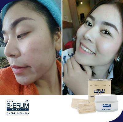 รีวิวจากผู้ใช้ S-ERUM ทั่วประเทศ 59.jpg