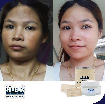 รีวิวจากผู้ใช้ S-ERUM ทั่วประเทศ 60.jpg