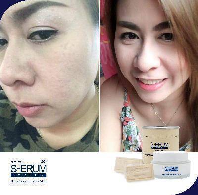 รีวิวจากผู้ใช้ S-ERUM ทั่วประเทศ 63.jpg