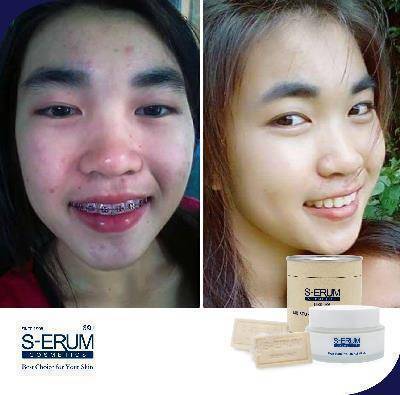 รีวิวจากผู้ใช้ S-ERUM ทั่วประเทศ 64.jpg