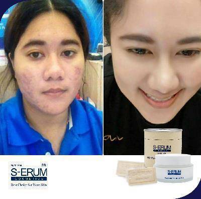 รีวิวจากผู้ใช้ S-ERUM ทั่วประเทศ 65.jpg